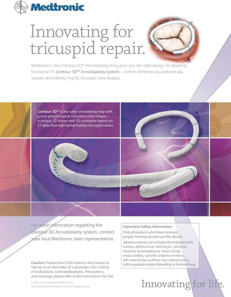 Contour 3D is the only remodeling ring with a true physiological tricuspid valve shape a unique 2D shape and 3D curvature based on CT data from functional human tricuspid valves.