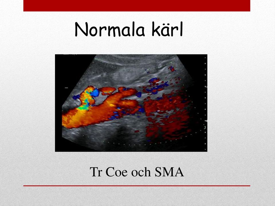 Coe och