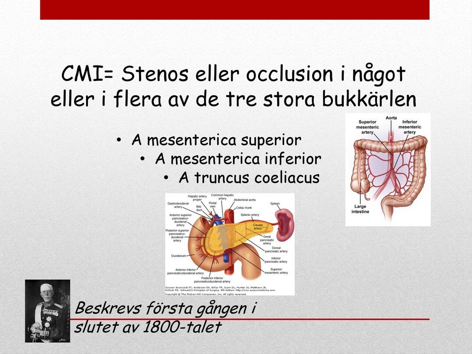 superior A mesenterica inferior A truncus