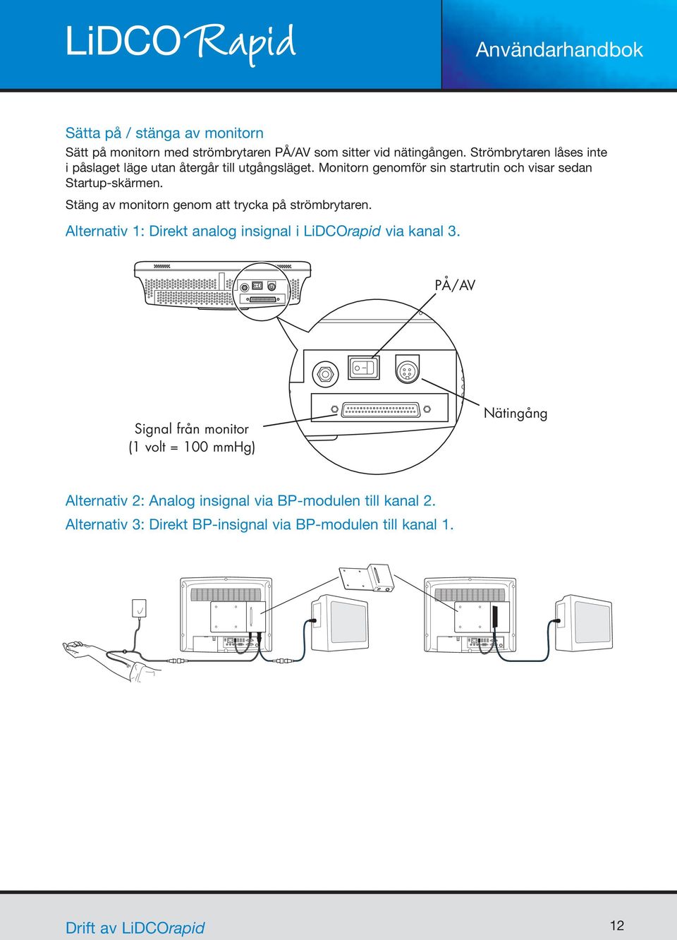 Stäng av monitorn genom att trycka på strömbrytaren. Alternativ 1: Direkt analog insignal i LiDCOrapid via kanal 3.