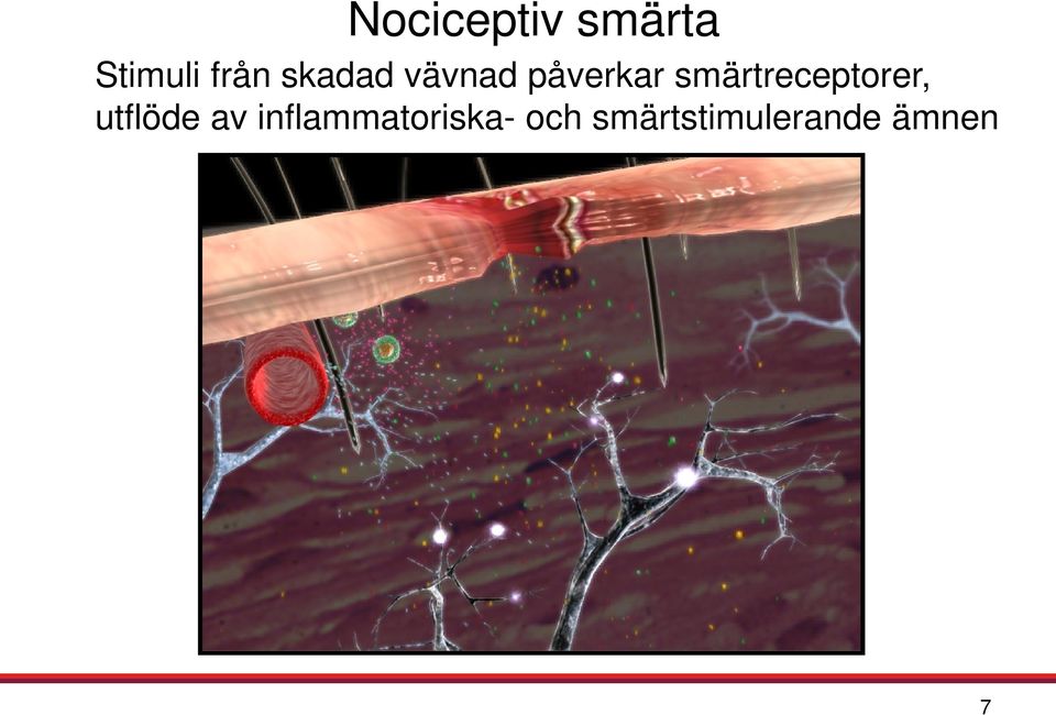 smärtreceptorer, utflöde av