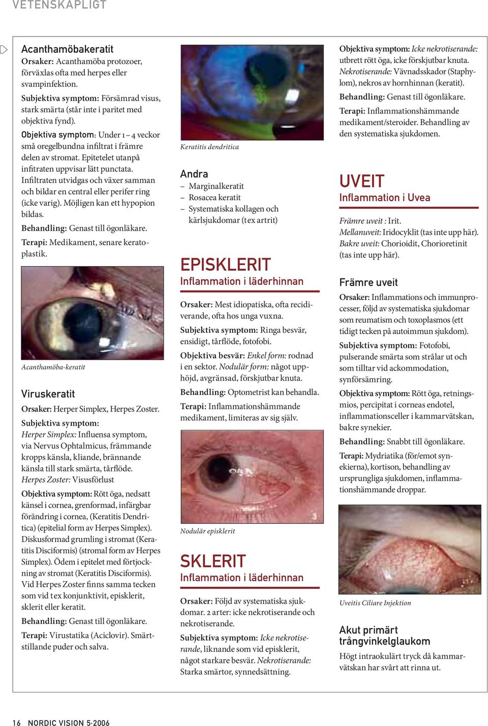 Epitetelet utanpå infitraten uppvisar lätt punctata. Infiltraten utvidgas och växer samman och bildar en central eller perifer ring (icke varig). Möjligen kan ett hypopion bildas.