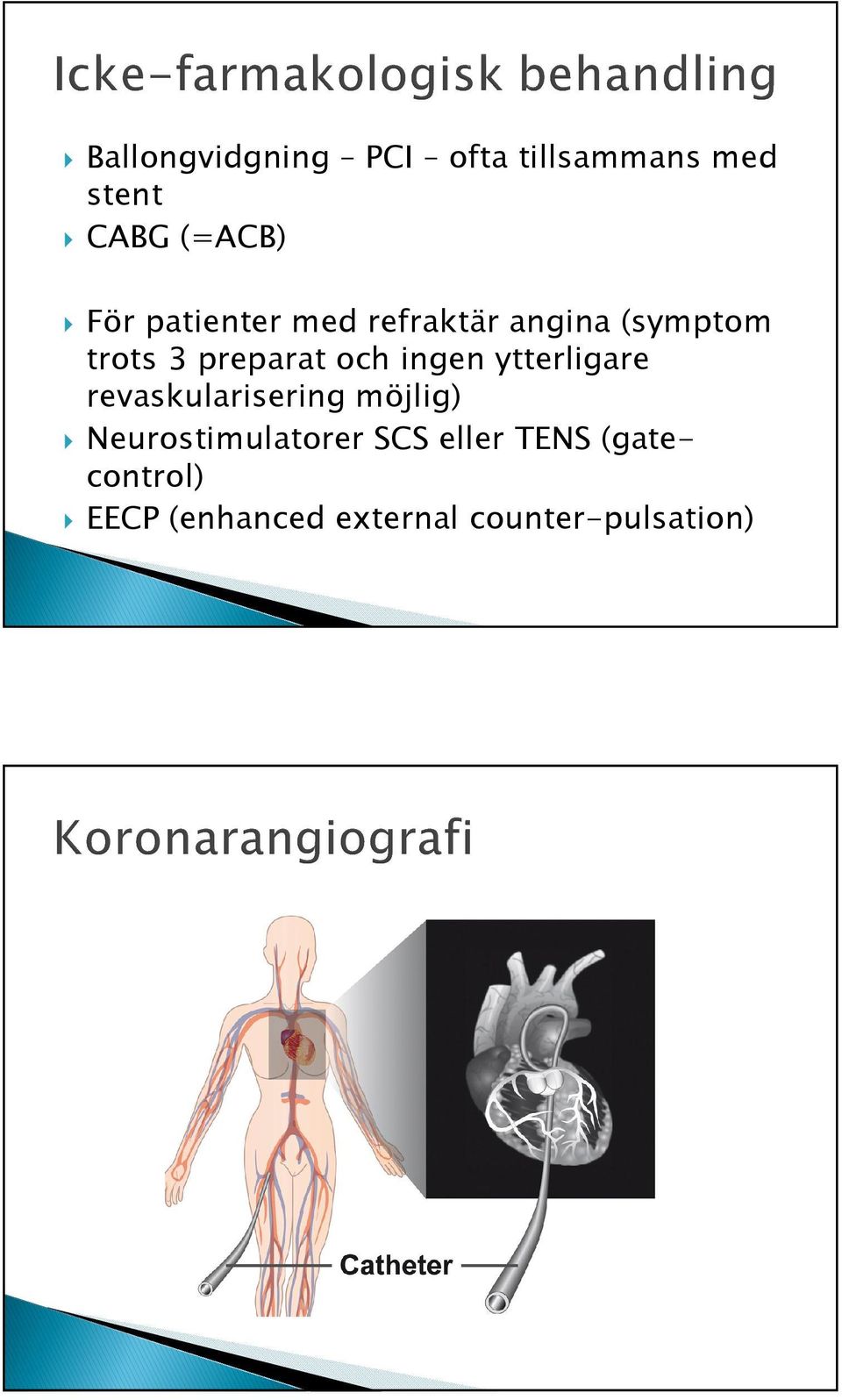 ingen ytterligare revaskularisering möjlig) Neurostimulatorer