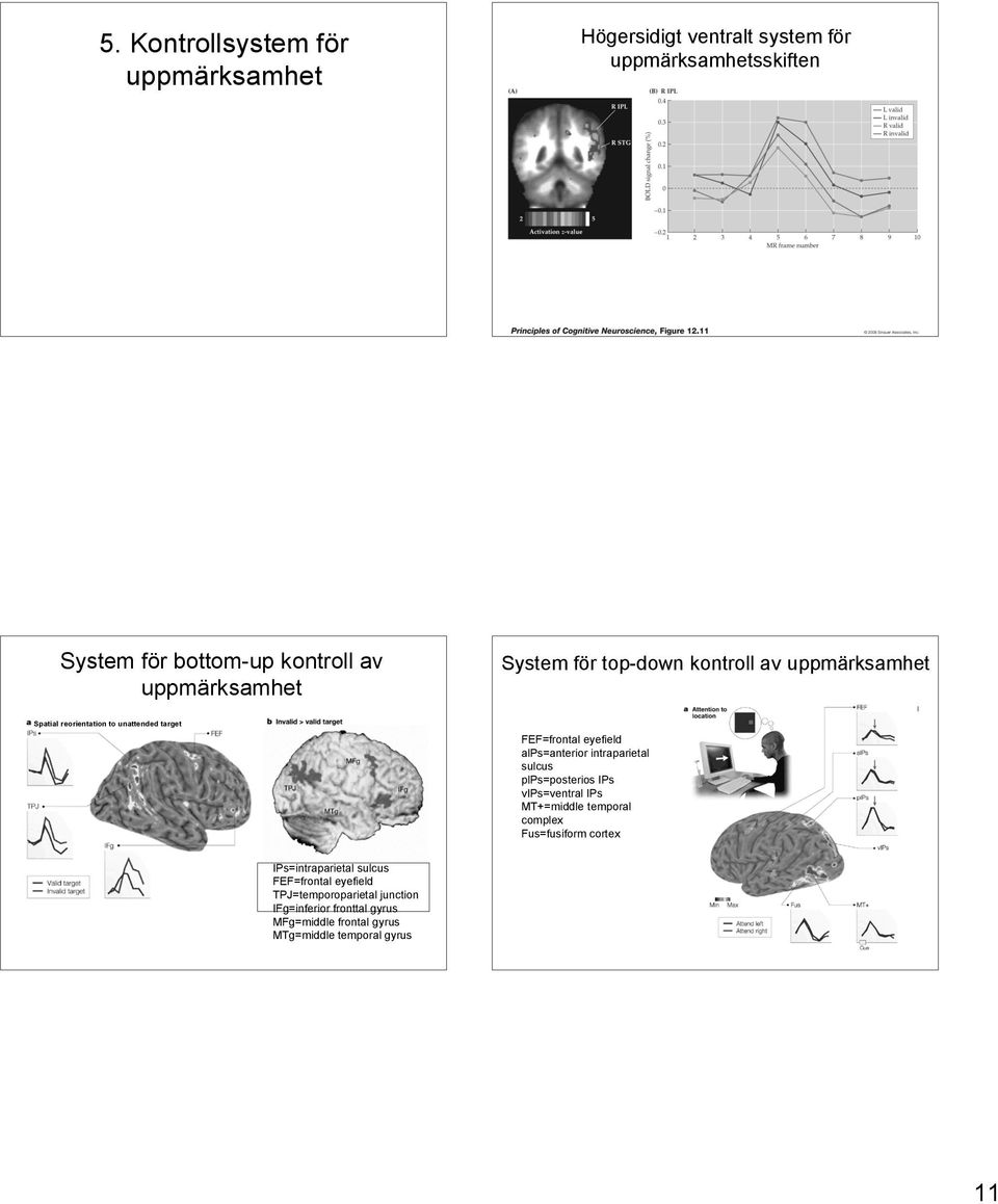 alps=anterior intraparietal sulcus plps=posterios IPs vips=ventral IPs MT+=middle temporal complex Fus=fusiform cortex