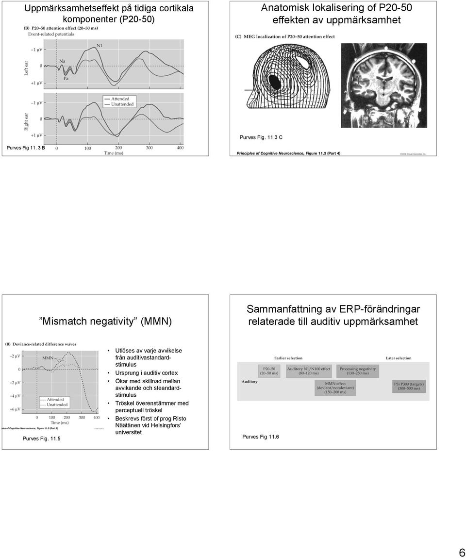 11.5 Utlöses av varje avvikelse från auditivastandardstimulus Ursprung i auditiv cortex Ökar med skillnad mellan avvikande och