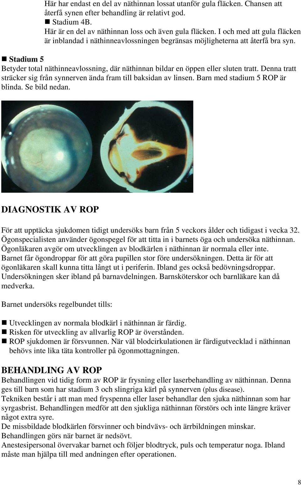 Denna tratt sträcker sig från synnerven ända fram till baksidan av linsen. Barn med stadium 5 ROP är blinda. Se bild nedan.