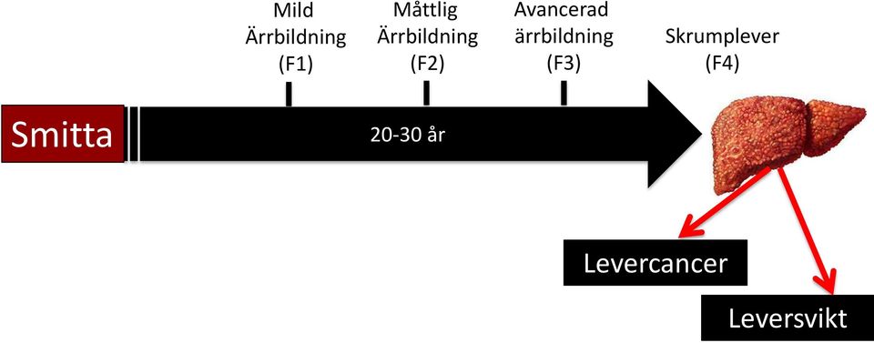 ärrbildning (F3) Skrumplever