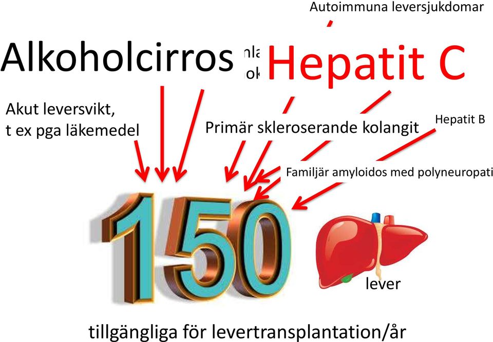 läkemedel Primär skleroserande kolangit Hepatit B Familjär