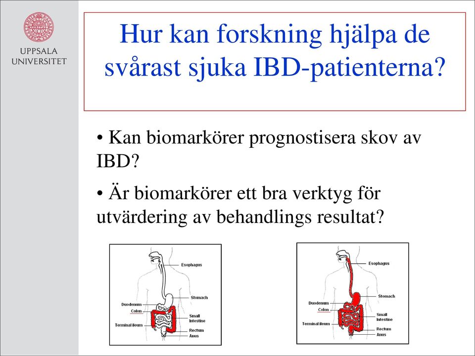 Kan biomarkörer prognostisera skov av IBD?