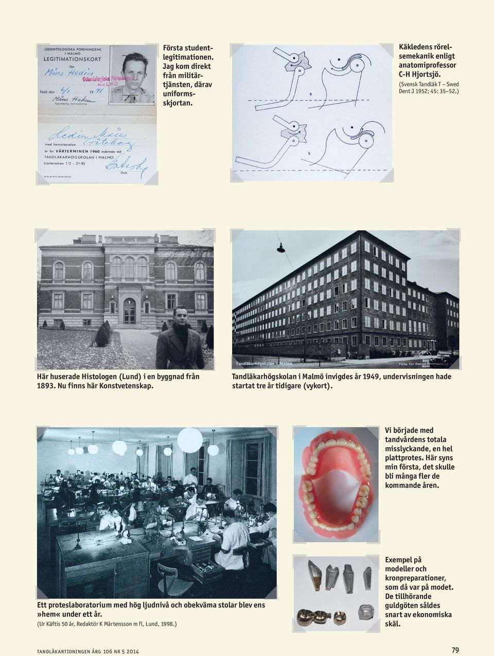 Vi började med tandvårdens totala misslyckande, en hel plattprotes. Här syns min första, det skulle bli många fler de kommande åren.