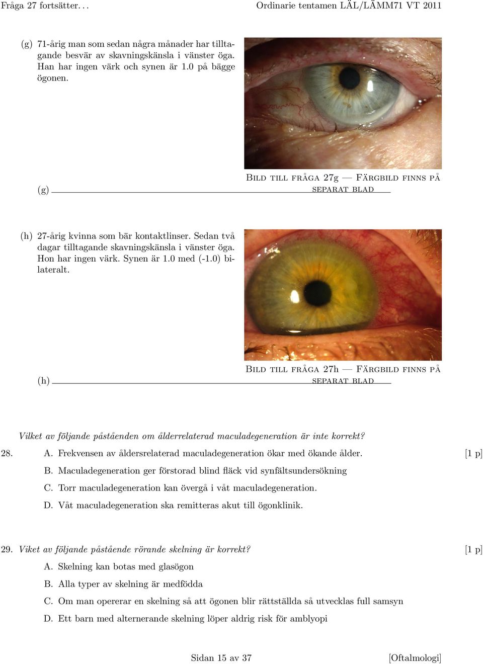 Synen är 1.0 med (-1.0) bilateralt. (h) Bild till fråga 27h Färgbild finns på separat blad Vilket av följande påståenden om ålderrelaterad maculadegeneration är inte korrekt? 28. A.