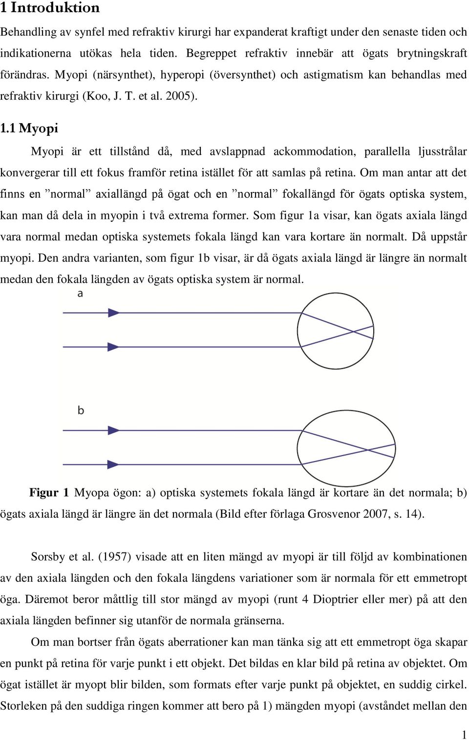 1 Myopi Myopi är ett tillstånd då, med avslappnad ackommodation, parallella ljusstrålar konvergerar till ett fokus framför retina istället för att samlas på retina.