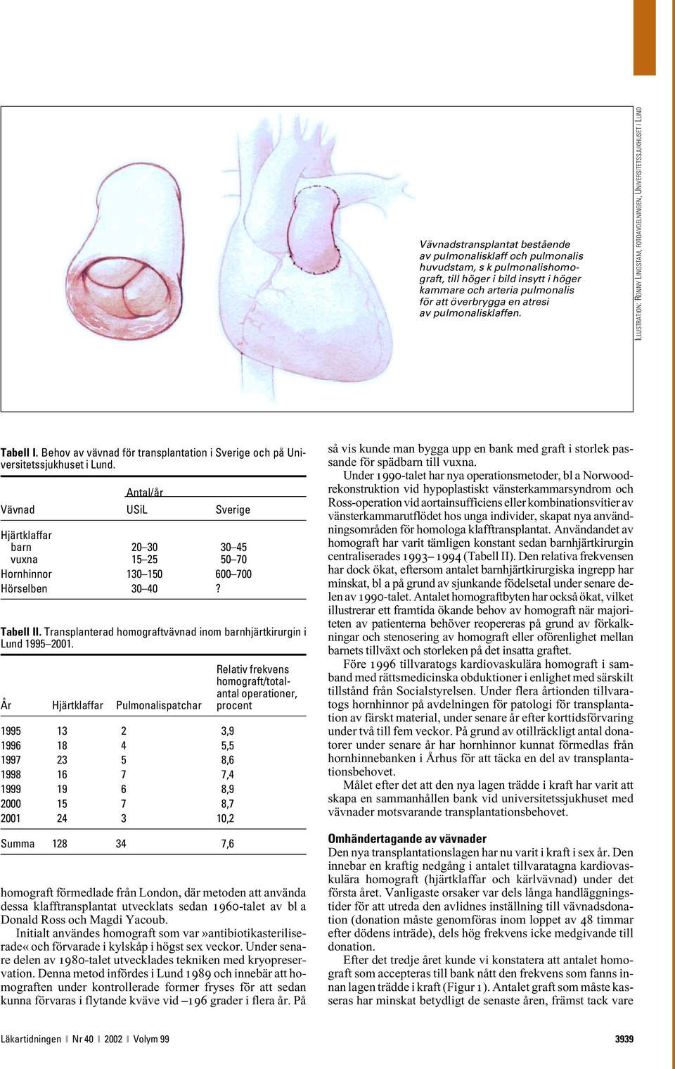 /år Vävnad USiL Sverige Hjärtklaffar barn 2 3 3 45 vuxna 15 25 5 7 Hornhinnor 13 15 6 7 Hörselben 3 4? Tabell II. Transplanterad homograftvävnad inom barnhjärtkirurgin i Lund 1995 21.