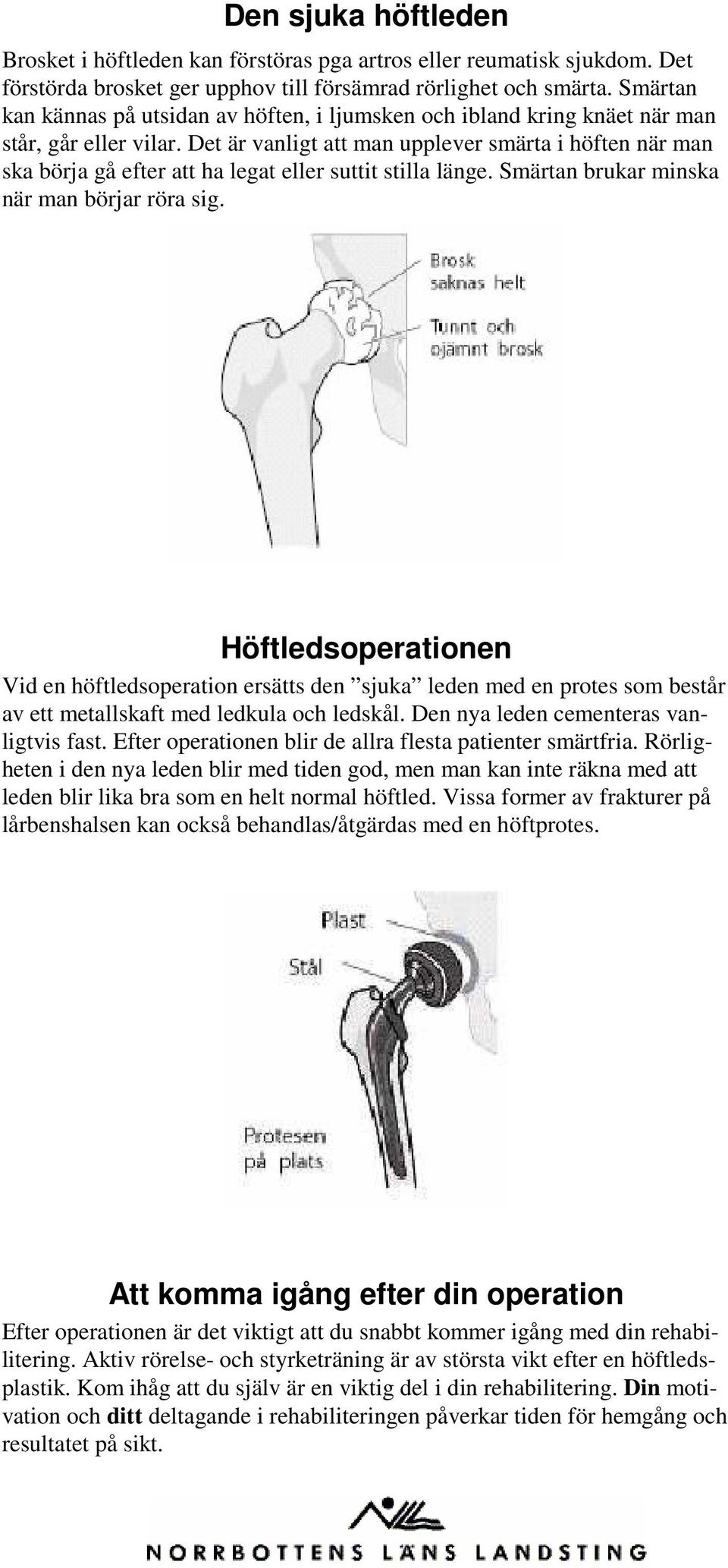 Det är vanligt att man upplever smärta i höften när man ska börja gå efter att ha legat eller suttit stilla länge. Smärtan brukar minska när man börjar röra sig.