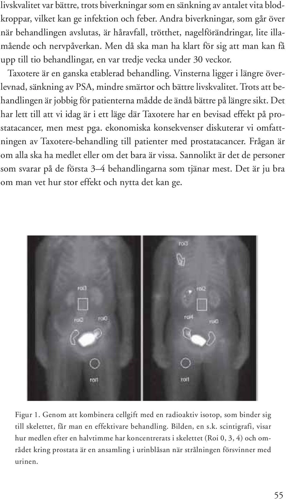 Men då ska man ha klart för sig att man kan få upp till tio behandlingar, en var tredje vecka under 30 veckor. Taxotere är en ganska etablerad behandling.