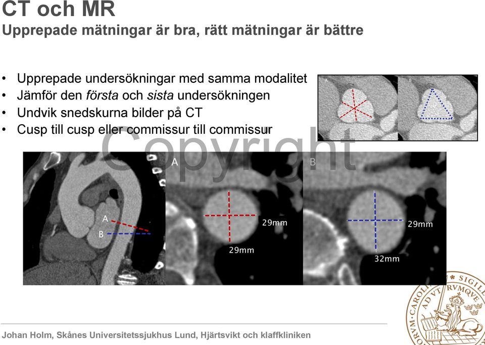 Jämför den första och sista undersökningen Undvik