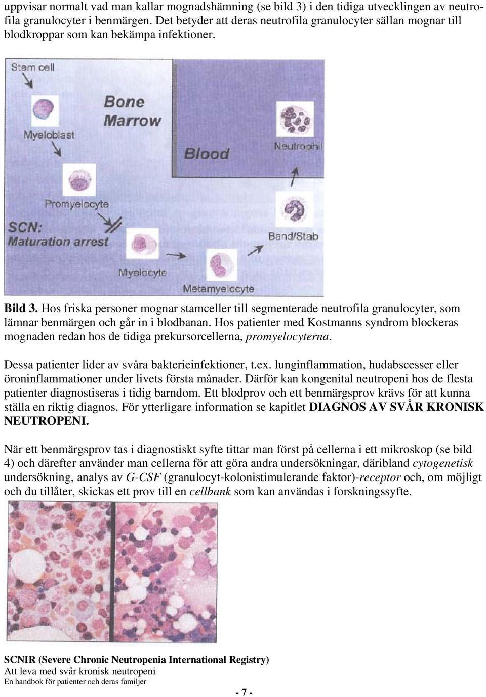 Hos friska personer mognar stamceller till segmenterade neutrofila granulocyter, som lämnar benmärgen och går in i blodbanan.