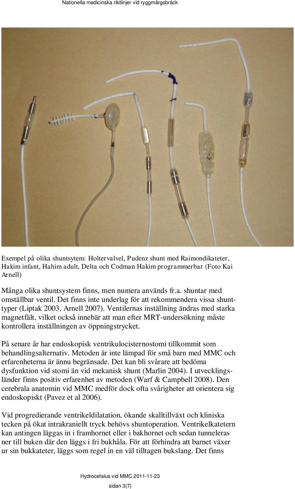 Ventilernas inställning ändras med starka magnetfält, vilket också innebär att man efter MRT-undersökning måste kontrollera inställningen av öppningstrycket.