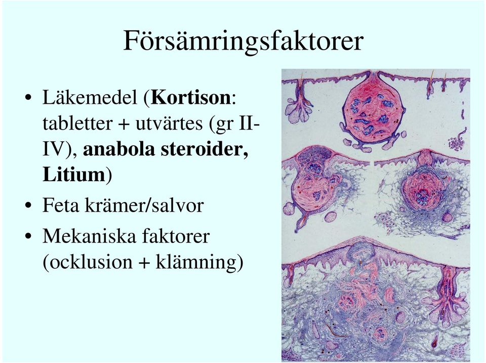 anabola steroider, Litium) Feta