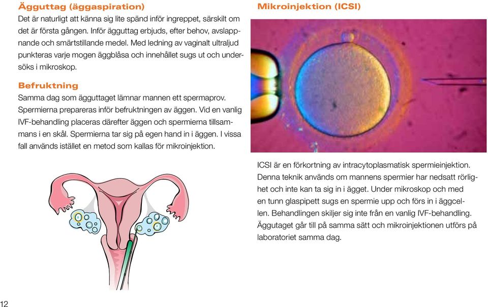 Mikroinjektion (ICSI) Befruktning Samma dag som ägguttaget lämnar mannen ett spermaprov. Spermierna prepareras inför befruktningen av äggen.
