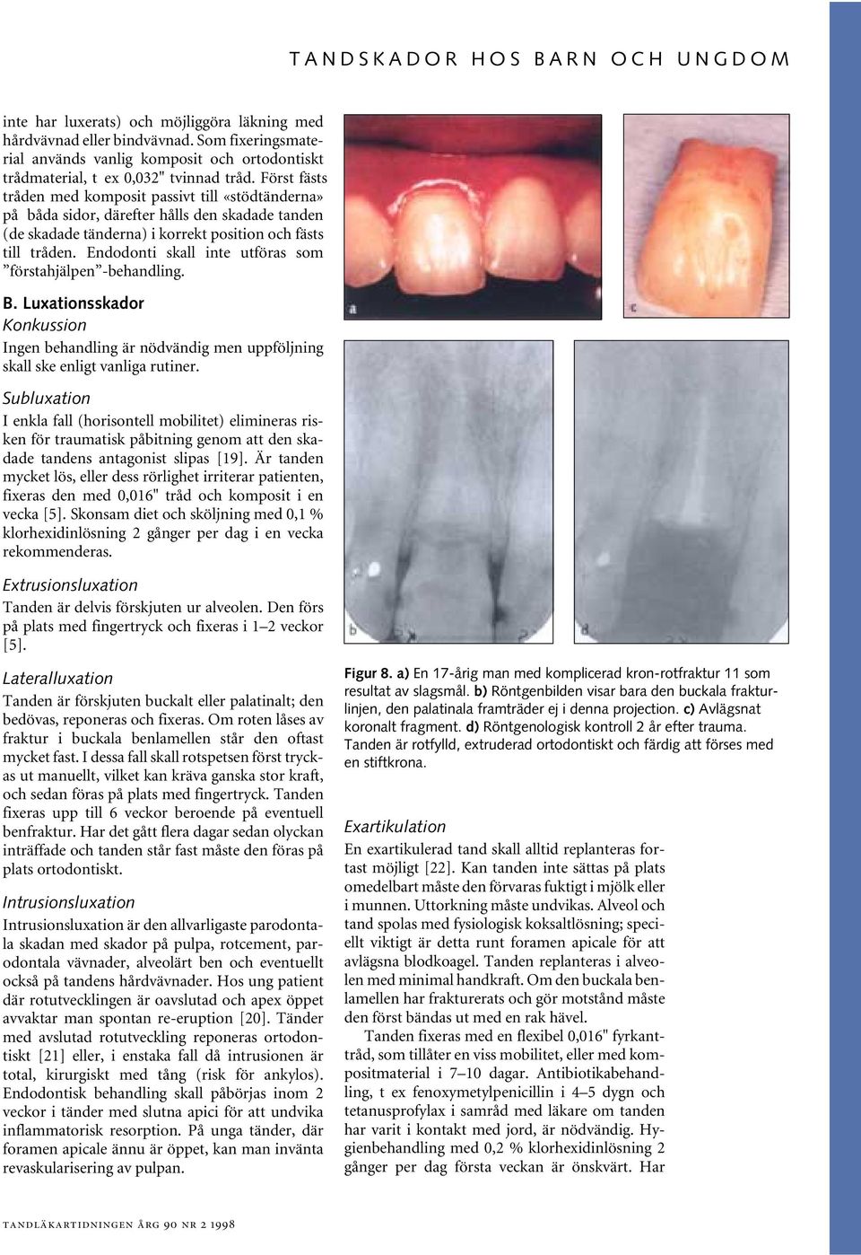 Endodonti skll inte utförs som försthjälpen -ehndling. B. Luxtionsskdor Konkussion Ingen ehndling är nödvändig men uppföljning skll ske enligt vnlig rutiner.