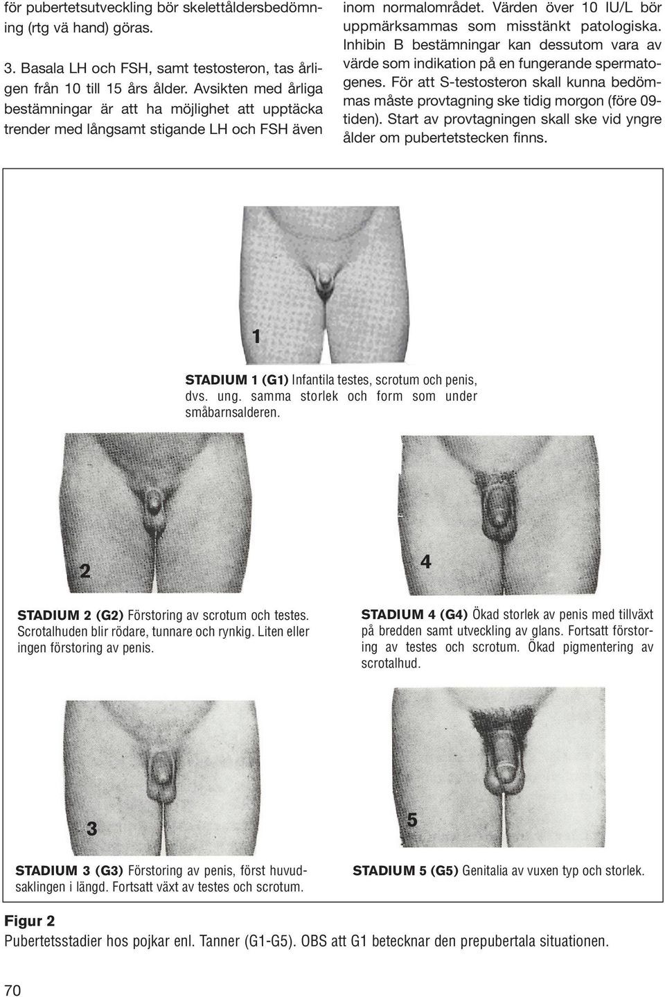 Inhibin B bestämningar kan dessutom vara av värde som indikation på en fungerande spermatogenes. För att S-testosteron skall kunna bedömmas måste provtagning ske tidig morgon (före 09- tiden).