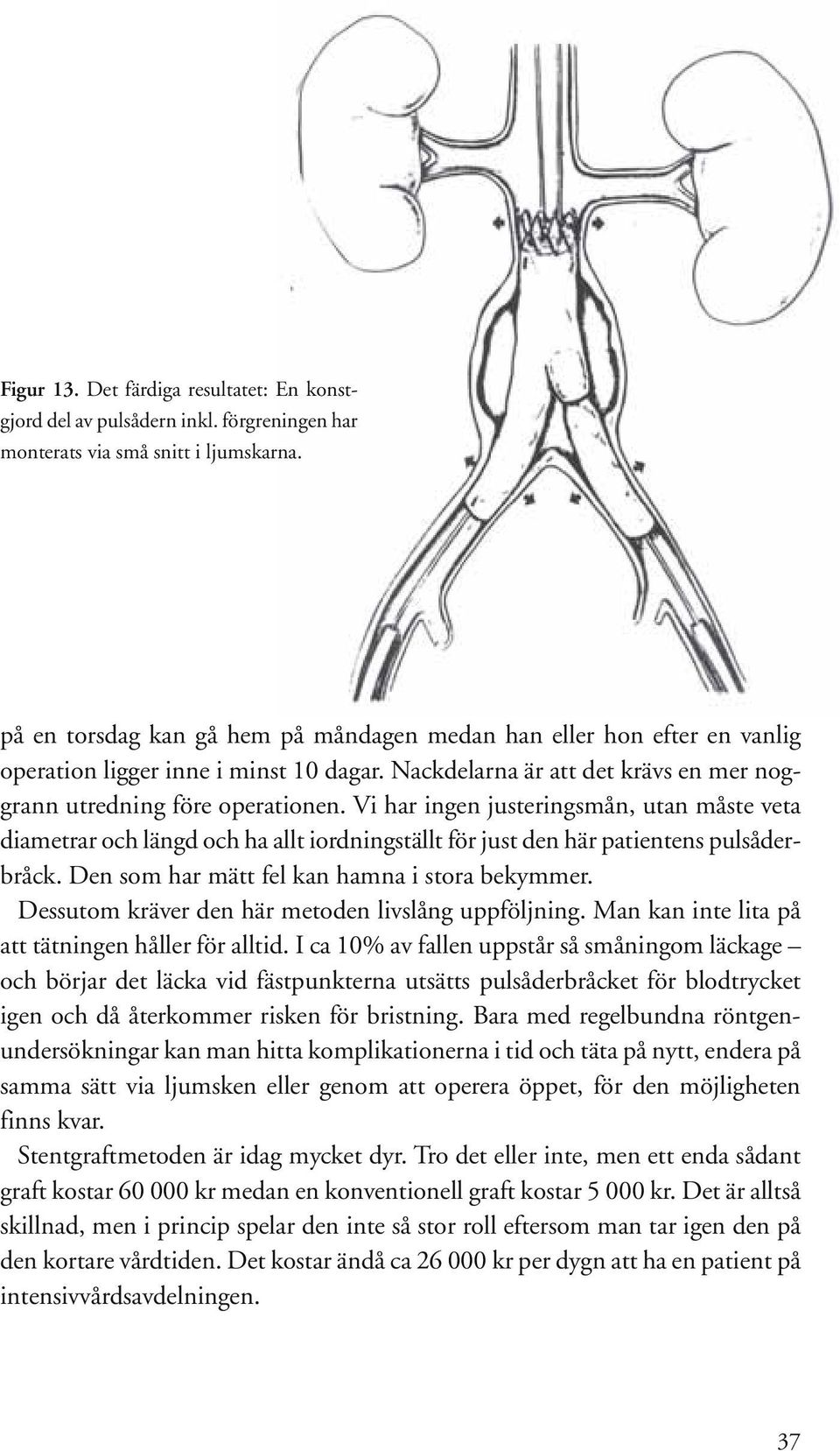 Vi har ingen justeringsmån, utan måste veta diametrar och längd och ha allt iordningställt för just den här patientens pulsåderbråck. Den som har mätt fel kan hamna i stora bekymmer.