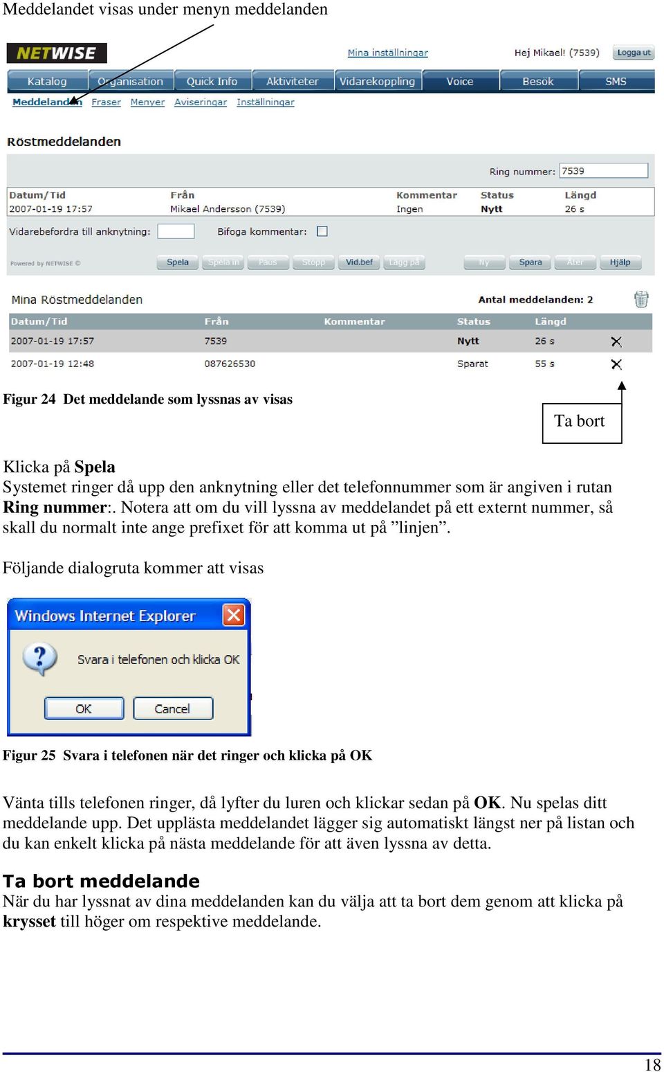 Följande dialogruta kommer att visas Figur 25 Svara i telefonen när det ringer och klicka på OK Vänta tills telefonen ringer, då lyfter du luren och klickar sedan på OK. Nu spelas ditt meddelande upp.