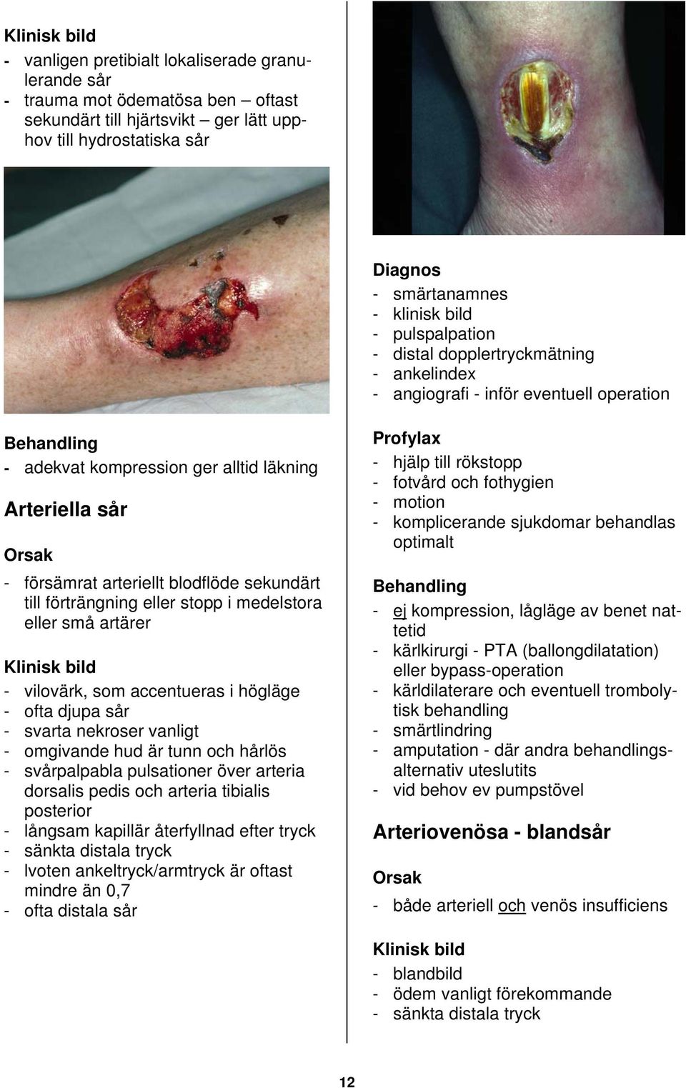 blodflöde sekundärt till förträngning eller stopp i medelstora eller små artärer Klinisk bild - vilovärk, som accentueras i högläge - ofta djupa sår - svarta nekroser vanligt - omgivande hud är tunn