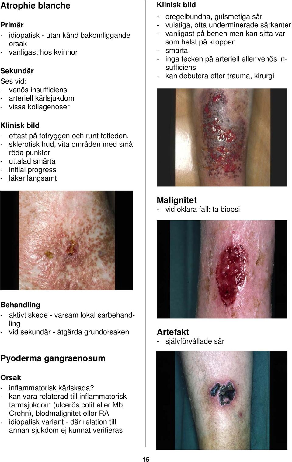 debutera efter trauma, kirurgi Klinisk bild - oftast på fotryggen och runt fotleden.