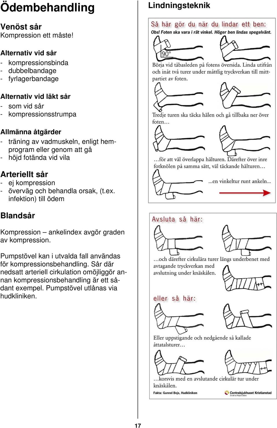 vadmuskeln, enligt hemprogram eller genom att gå - höjd fotända vid vila Arteriellt sår - ej kompression - överväg och behandla orsak, (t.ex.