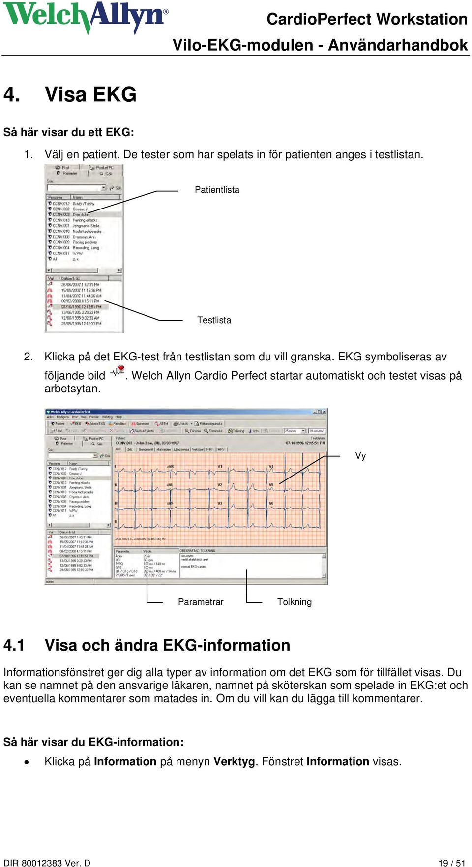 Vy Parametrar Tolkning 4.1 Visa och ändra EKG-information Informationsfönstret ger dig alla typer av information om det EKG som för tillfället visas.