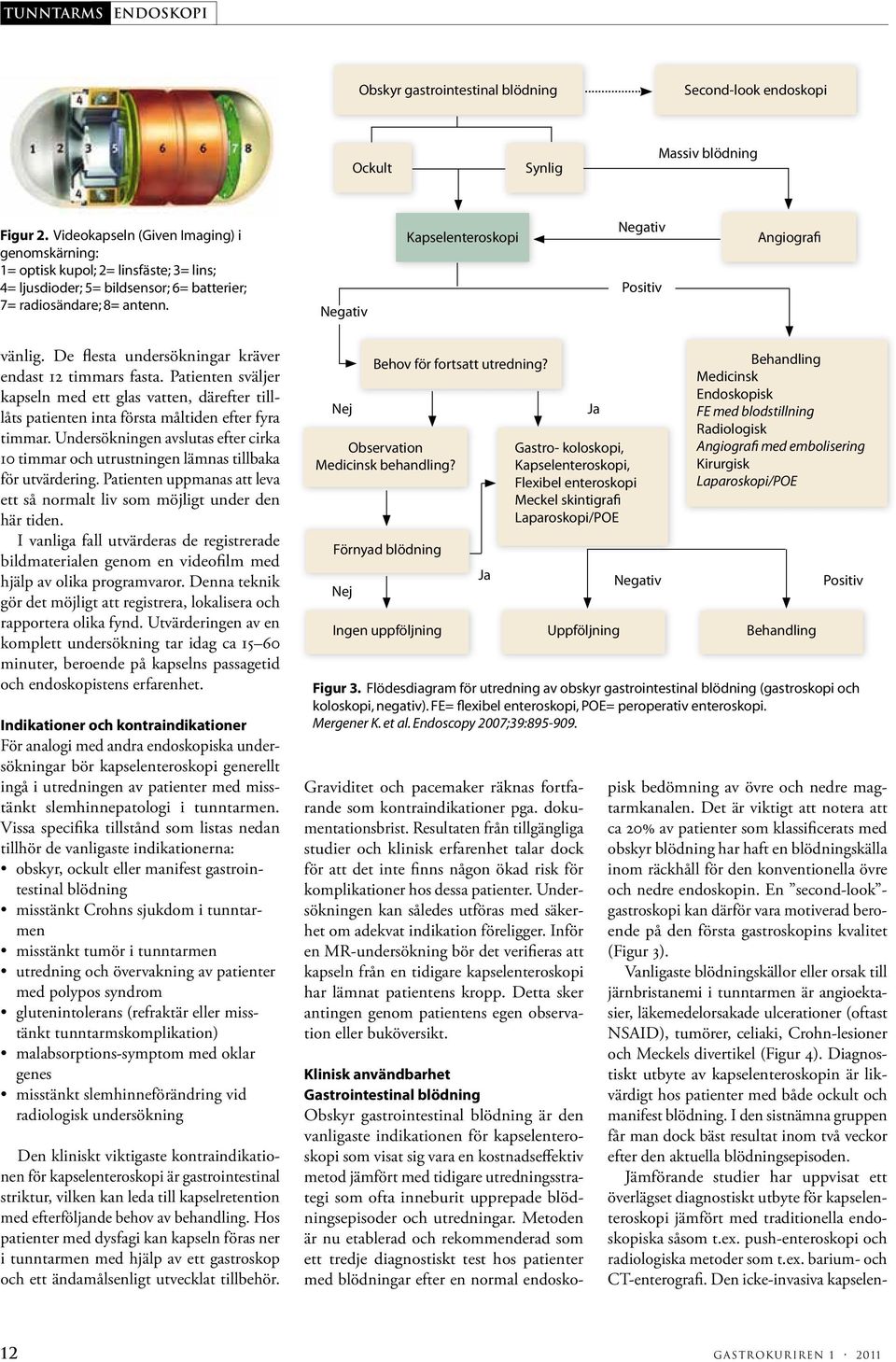 Negativ Kapselenteroskopi Negativ Positiv Angiografi vänlig. De flesta undersökningar kräver endast 12 timmars fasta.