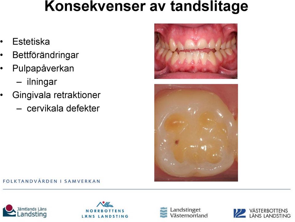 Pulpapåverkan ilningar