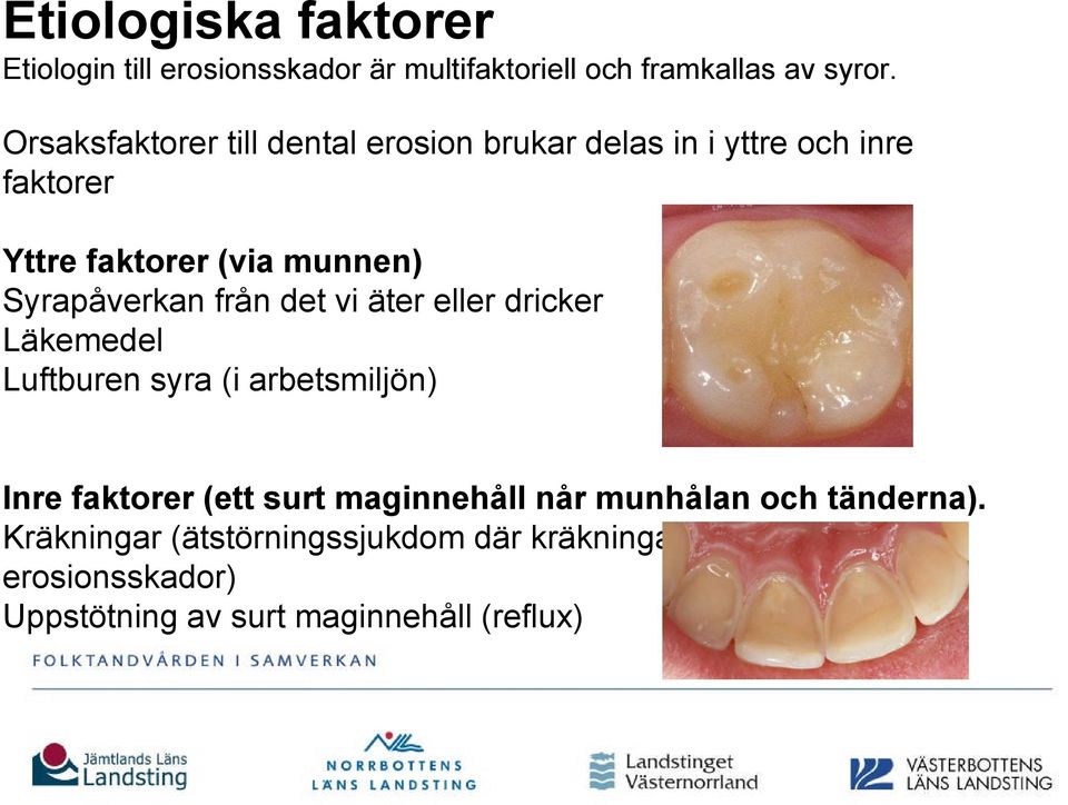 Syrapåverkan från det vi äter eller dricker Läkemedel Luftburen syra (i arbetsmiljön) Inre faktorer (ett surt