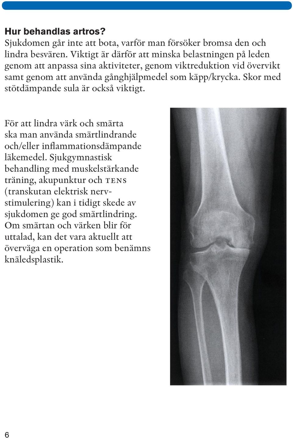 Skor med stötdämpande sula är också viktigt. För att lindra värk och smärta ska man använda smärtlindrande och/eller inflammationsdämpande läkemedel.