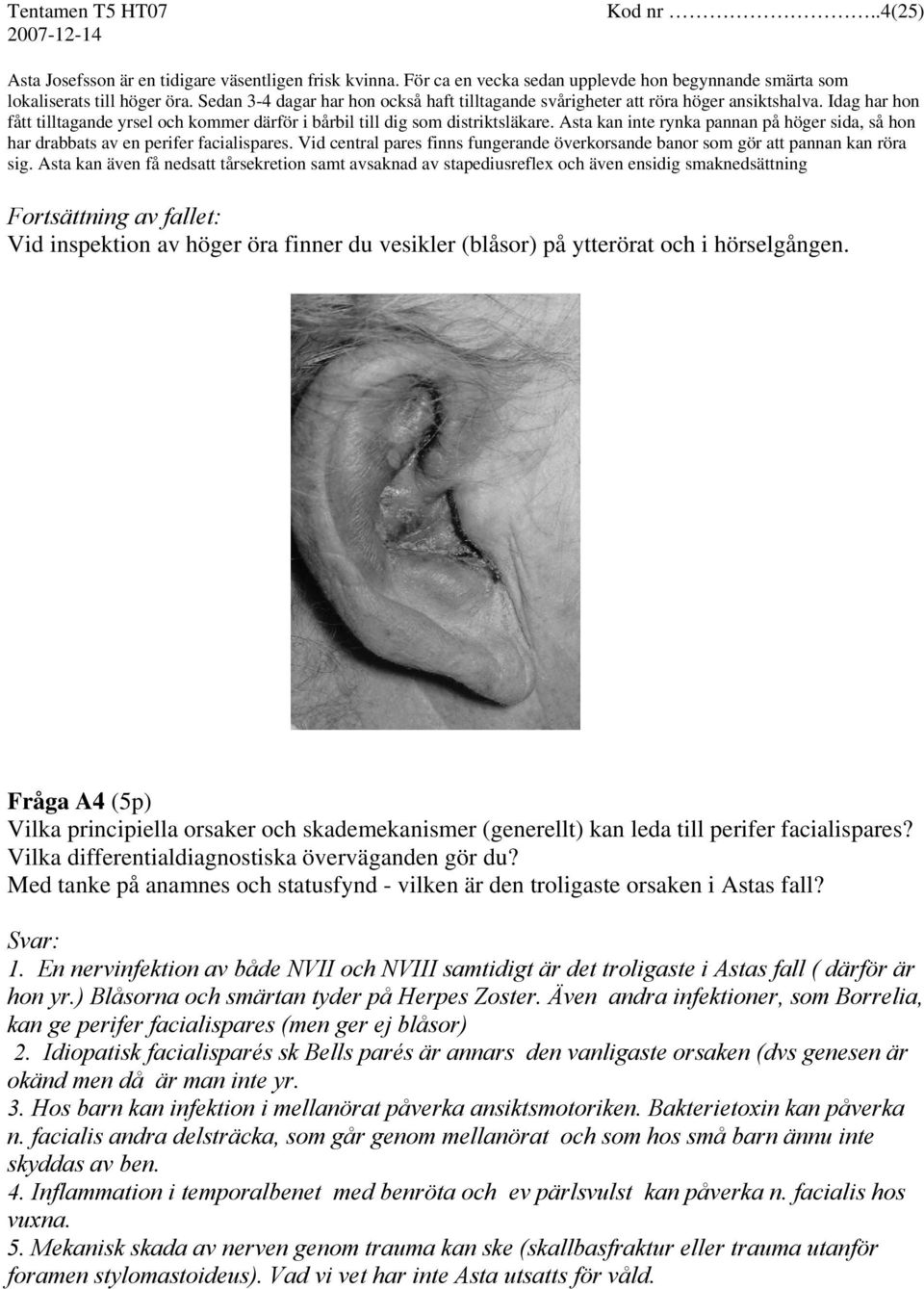 Asta kan inte rynka pannan på höger sida, så hon har drabbats av en perifer facialispares. Vid central pares finns fungerande överkorsande banor som gör att pannan kan röra sig.