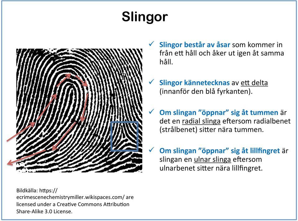 ü Om slingan öppnar sig åt tummen är det en radial slinga esersom radialbenet (strålbenet) siher nära tummen.