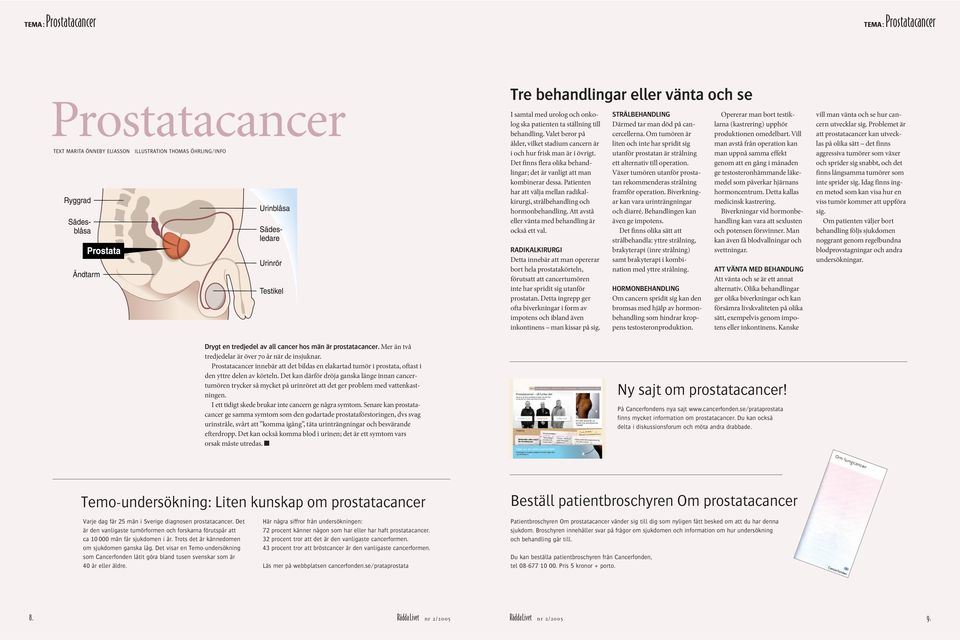 Det kan därför dröja ganska länge innan cancertumören trycker så mycket på urinröret att det ger problem med vattenkastningen. I ett tidigt skede brukar inte cancern ge några symtom.