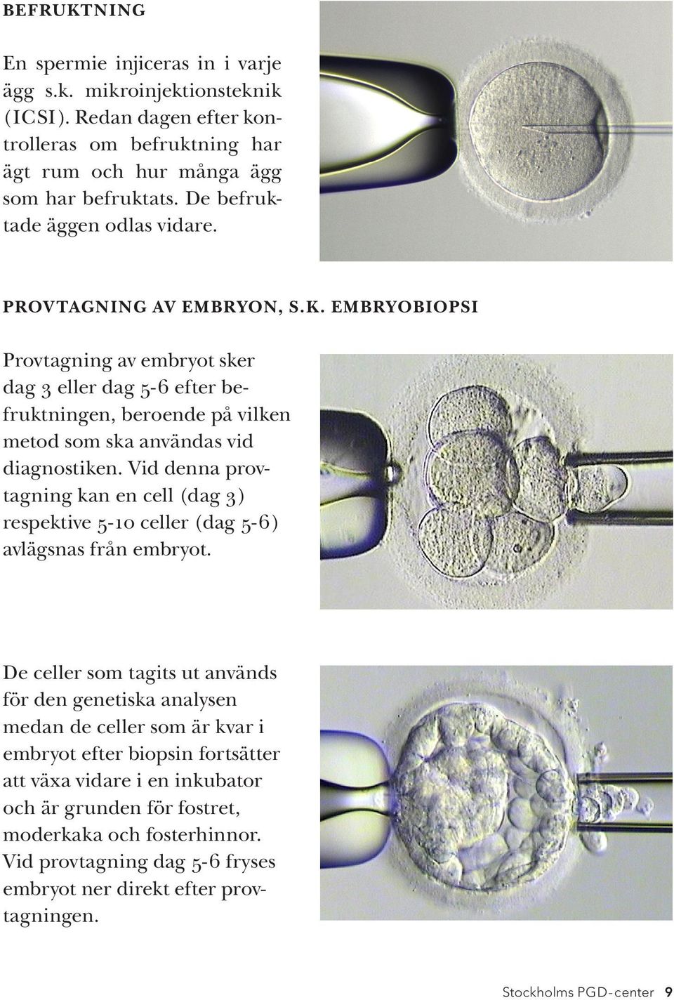 EMBRYOBIOPSI Provtagning av embryot sker dag 3 eller dag 5-6 efter befruktningen, beroende på vilken metod som ska användas vid diagnostiken.