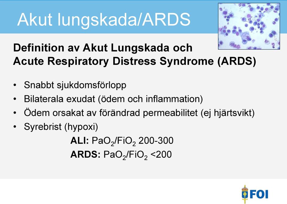 och inflammation) Ödem orsakat av förändrad permeabilitet (ej