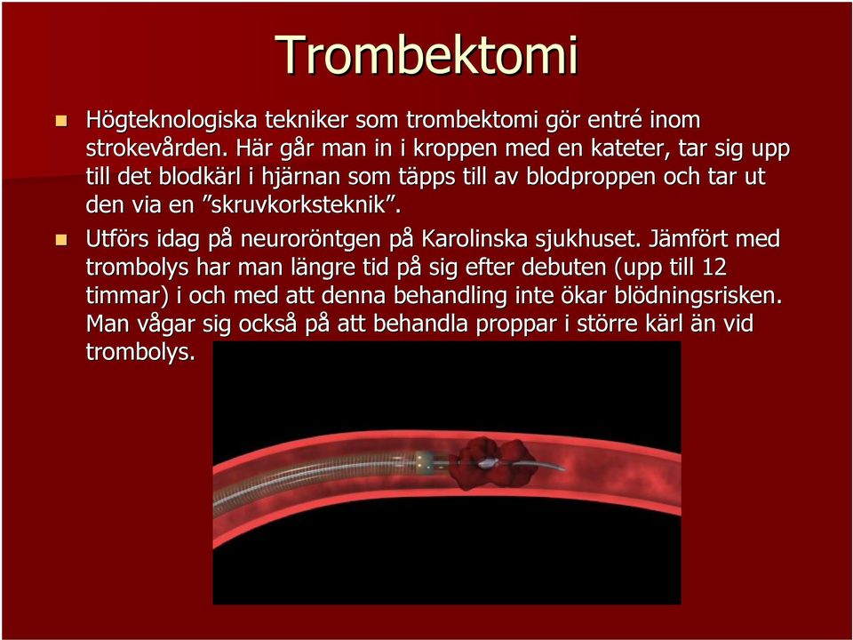 den via en skruvkorksteknik. Utförs idag påp neuroröntgen ntgen påp Karolinska sjukhuset.