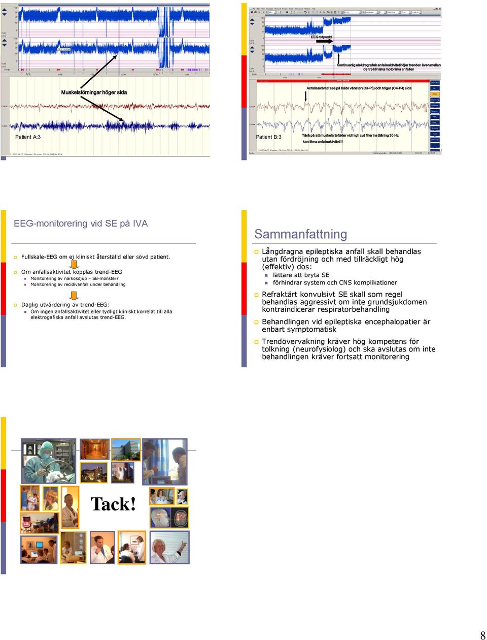 !! EEG-monitorering vid SE på IVA Sammanfattning Fullskale-EEG om ej kliniskt återställd eller sövd patient. Om anfallsaktivitet kopplas trend-eeg Monitorering av narkosdjup SB-mönster?