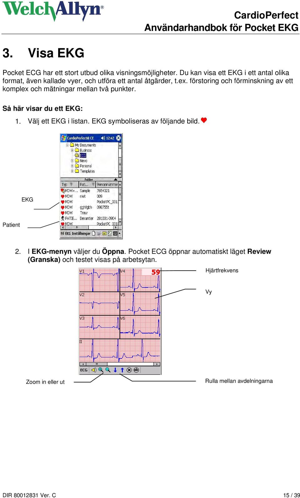 förstoring och förminskning av ett komplex och mätningar mellan två punkter. Så här visar du ett EKG: 1. Välj ett EKG i listan.