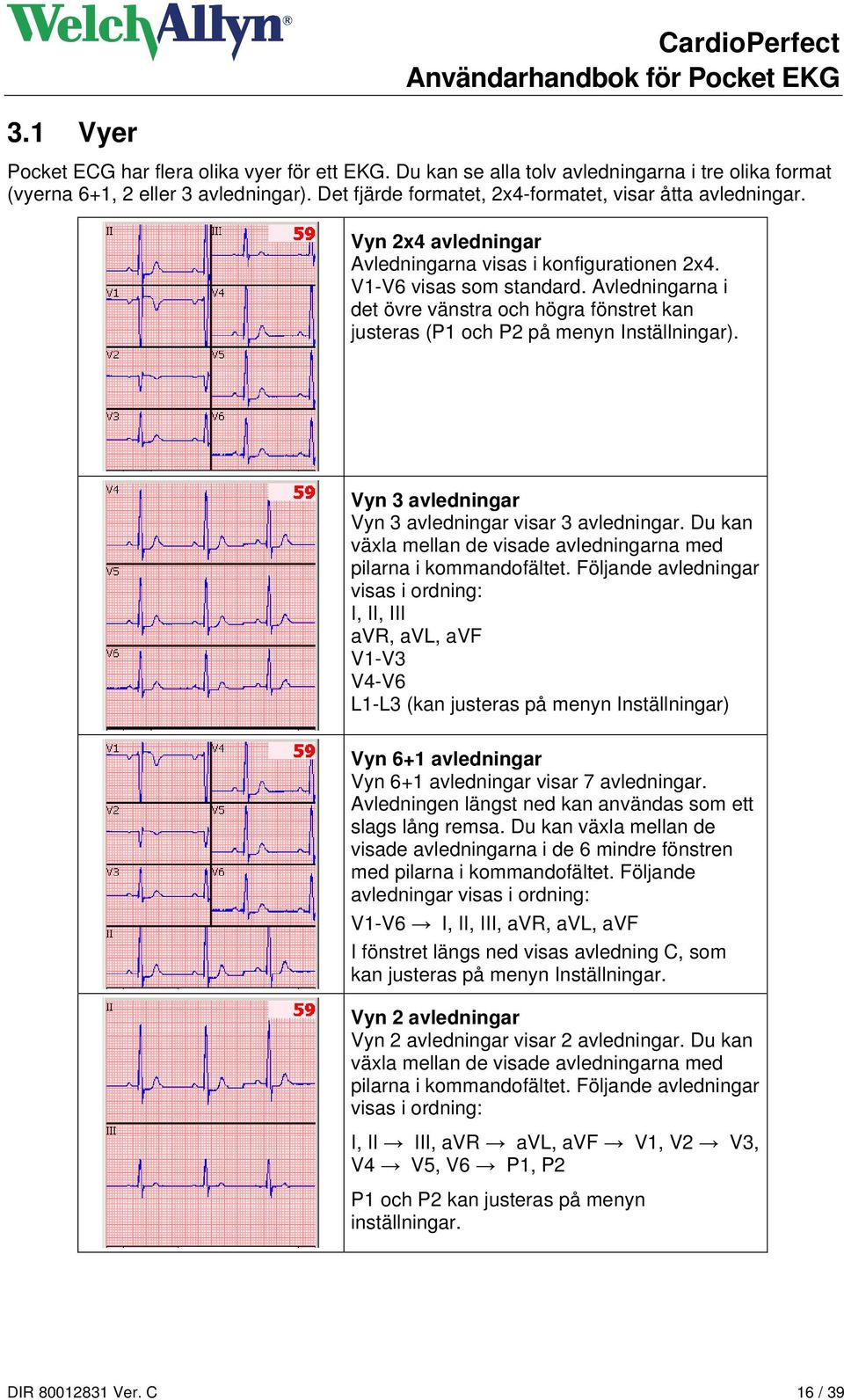 Avledningarna i det övre vänstra och högra fönstret kan justeras (P1 och P2 på menyn Inställningar). Vyn 3 avledningar Vyn 3 avledningar visar 3 avledningar.