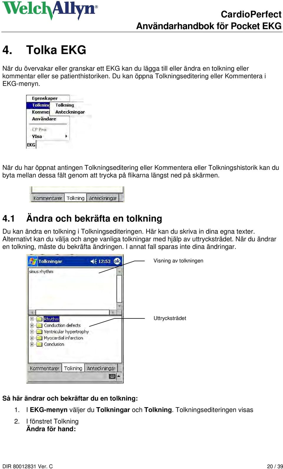 1 Ändra och bekräfta en tolkning Du kan ändra en tolkning i Tolkningsediteringen. Här kan du skriva in dina egna texter.