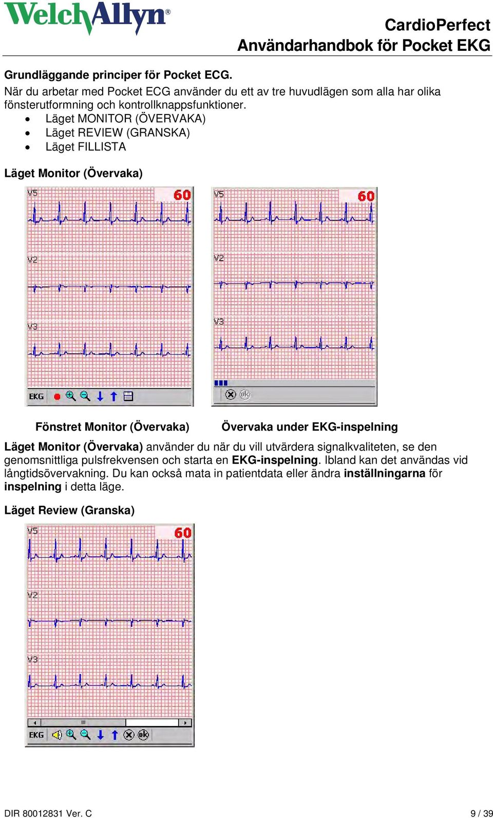 Läget MONITOR (ÖVERVAKA) Läget REVIEW (GRANSKA) Läget FILLISTA Läget Monitor (Övervaka) Fönstret Monitor (Övervaka) Övervaka under EKG-inspelning Läget Monitor