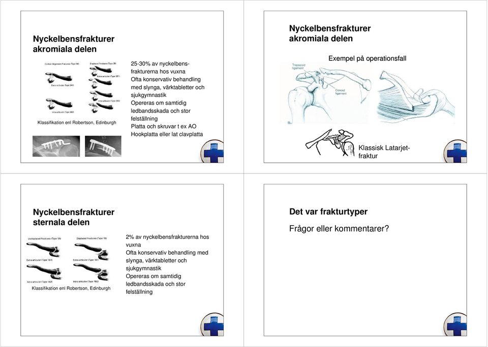 p operationsfall Klassisk Latarjetfraktur sternala delen Klassifikation enl Robertson, Edinburgh 2% av nyckelbensfrakturerna hos vuna Ofta konservativ