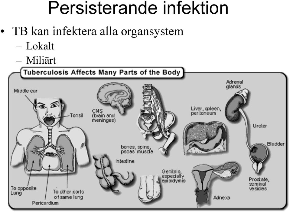 TB kan infektera