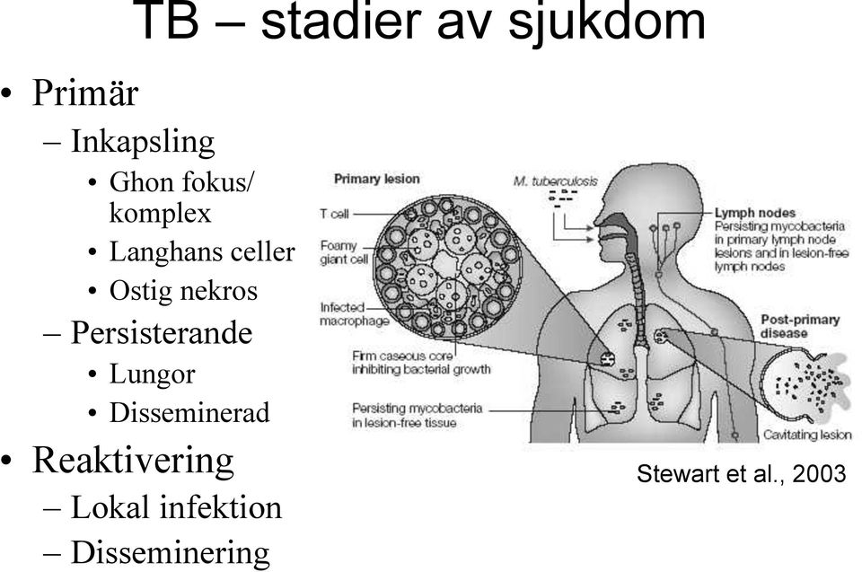 Ostig nekros! Persisterande! Lungor! Disseminerad!